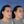 Cargar imagen en el visor de la galería, Otoplastia