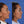 Cargar imagen en el visor de la galería, Blefaroplastia inferior