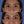 Cargar imagen en el visor de la galería, Blefaroplastia superior