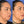 Load image in gallery viewer, Secondary rhinoplasty
