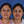 Cargar imagen en el visor de la galería, Rinoplastia