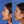 Cargar imagen en el visor de la galería, Rinoplastia