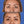Cargar imagen en el visor de la galería, Blefaroplastia superior