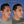 Cargar imagen en el visor de la galería, Otoplastia