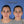 Cargar imagen en el visor de la galería, Otoplastia